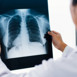 Descubra com a Dra. Thaline Neves Coutinho como a tomografia é essencial para identificar doenças pulmonares com precisão e segurança.