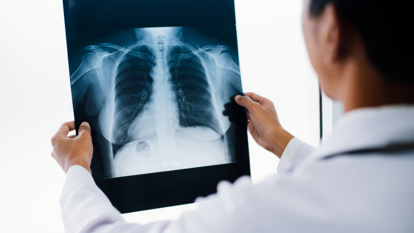 Descubra com a Dra. Thaline Neves Coutinho como a tomografia é essencial para identificar doenças pulmonares com precisão e segurança.