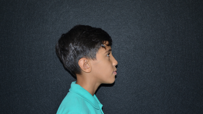 Para Milton Seigi Hayashi, o IMC é crucial na avaliação pré-cirúrgica para garantir segurança e resultados satisfatórios.